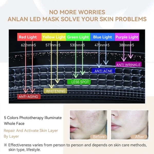 قناع وجه LED ANLAN - Image 3