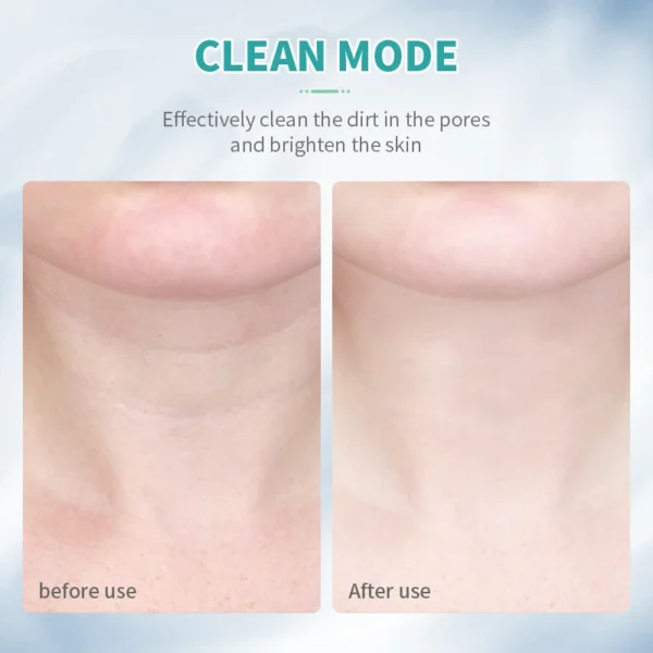 جهاز تجميل الوجه والرقبة- ANLAN- بتقنية -EMS- - Image 3